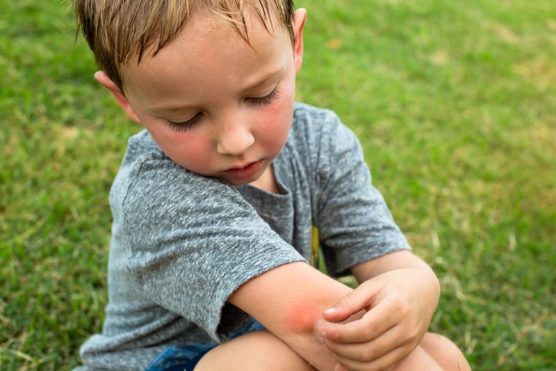 Enfermedades infantiles más frecuentes del verano