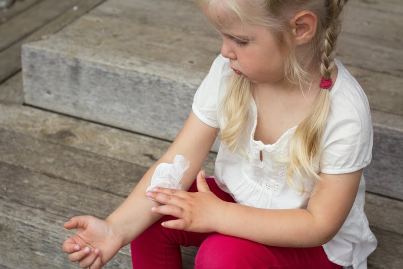 niña con urticaria se echa crema